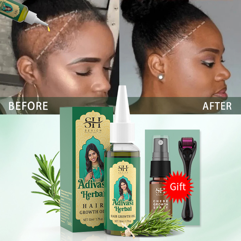 Minyak Pertumbuhan Rambut Ayur - Ingrown Hair Serum ulasan dan harga