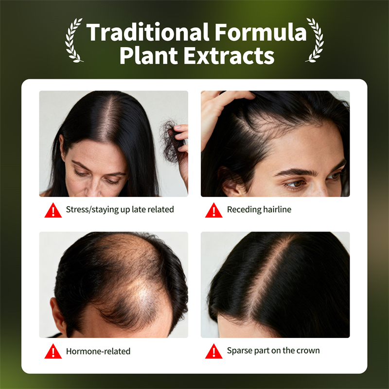Set Perawatan Rambut Alami Usm - Ingrown Hair Serum ulasan dan harga