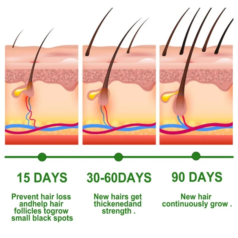 Serum Penumbuh Rambut Set Pera - Ingrown Hair Serum ulasan dan harga