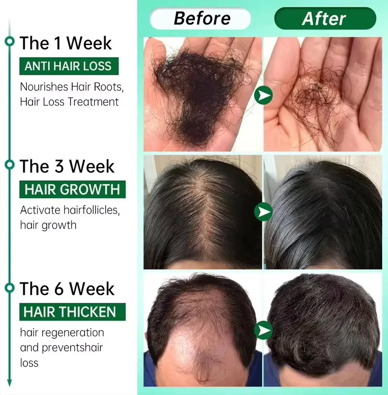 Serum Penumbuh Rambut 7 Hari P - Ingrown Hair Serum ulasan dan harga