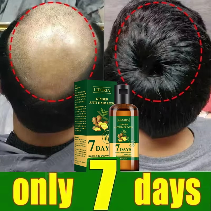 Serum Penumbuh Rambut 7 Hari P - Ingrown Hair Serum ulasan dan harga