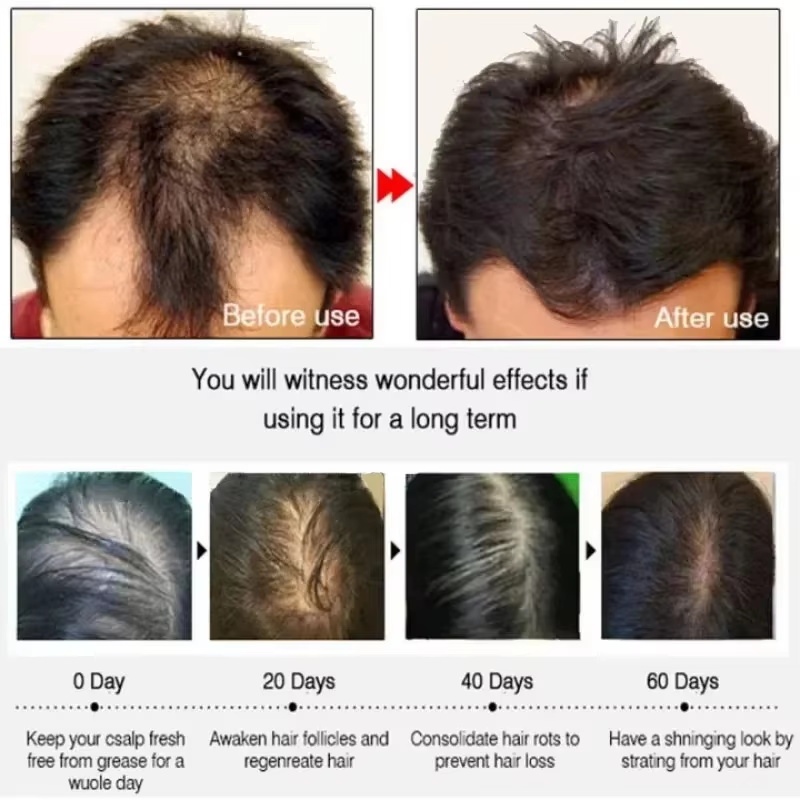 Serum Penumbuh Rambut 7 Hari P - Ingrown Hair Serum ulasan dan harga