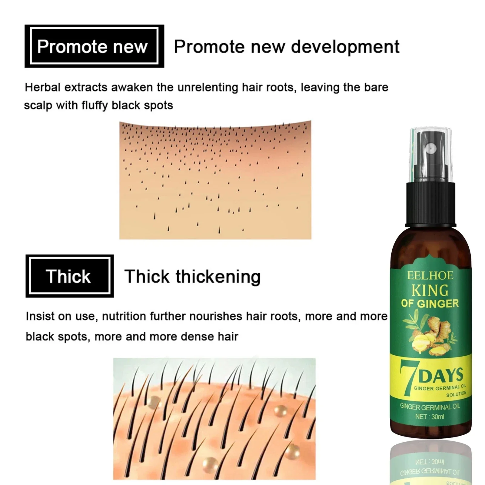 Serum penumbuh rambut jahe, se - Ingrown Hair Serum ulasan dan harga
