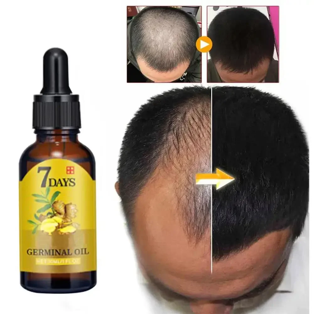 Minyak esensial penumbuh rambu - Ingrown Hair Serum ulasan dan harga