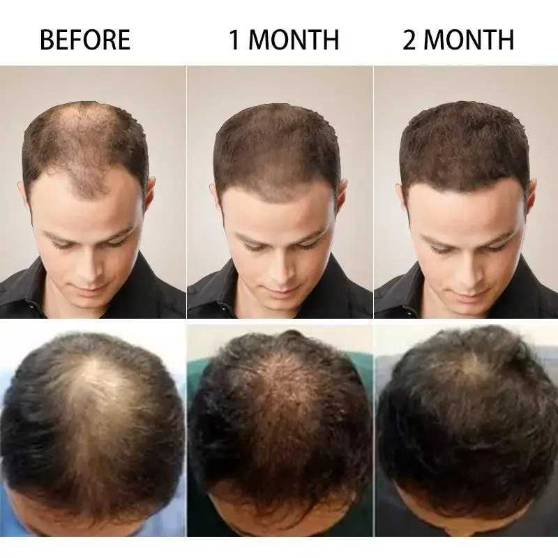 Minyak esensial penumbuh rambu - Ingrown Hair Serum ulasan dan harga